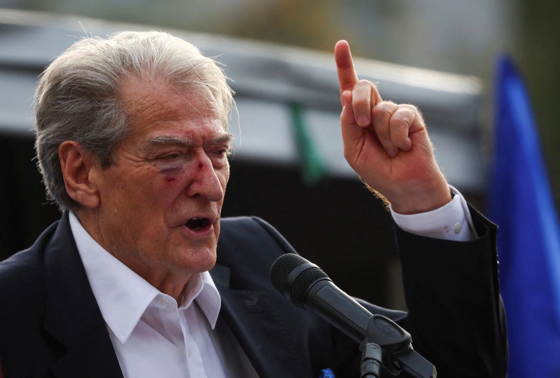 Cựu Tổng thống Albania vẫn phát biểu trước đám đông ủng hộ dù phần mặt còn vết máu. Ảnh: Reuters