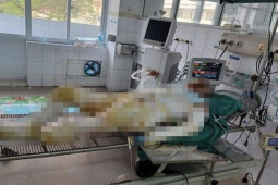 Pháp luật - Vụ 3 con gái phóng hoả đốt nhà mẹ đẻ: Sức khỏe người mẹ vẫn rất yếu