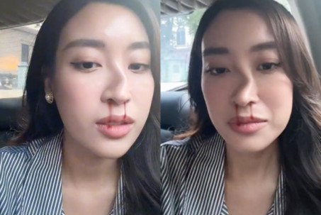Hoa hậu Đỗ Mỹ Linh đăng video bị "chồng đánh vẹo mũi" hot nhất năm 2022