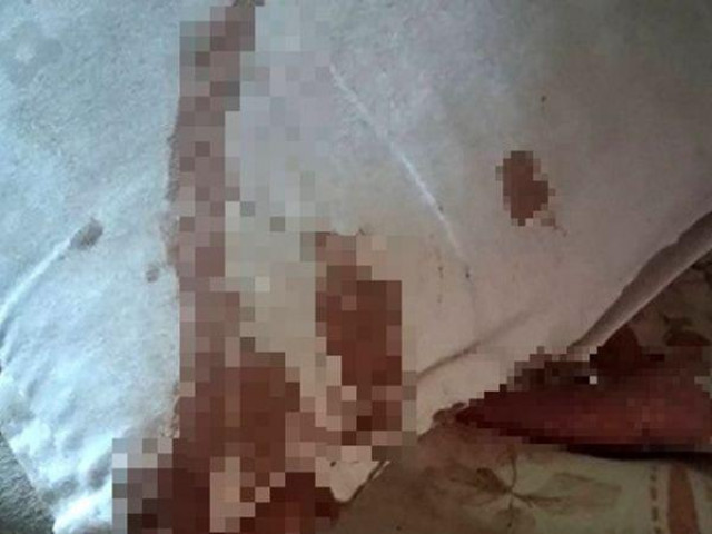 Phi thường - kỳ quặc - Đang ngủ thì thấy đau tai, người đàn ông đưa tay lên sờ thì phát hiện chuyện kinh hãi