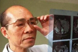 Nghiên cứu ung thư hàng chục năm, 5 viện sĩ đưa ra "bài thuốc chống ung thư" đơn giản nhưng ít người biết