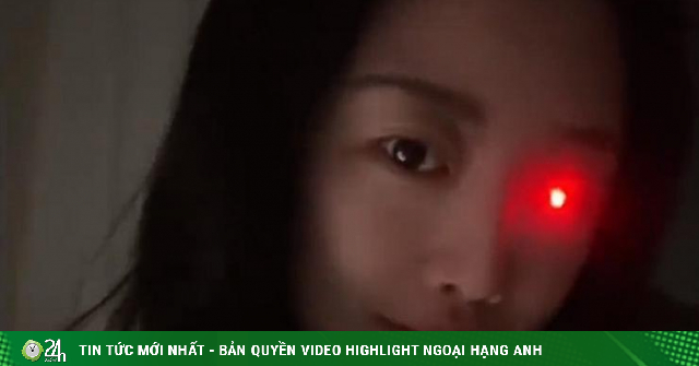 Cô gái trẻ mất 1 mắt vượt khó trở thành chuyên gia về mắt giả