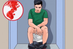 Ung thư hậu môn hiếm gặp nhưng nguy hiểm, dễ phát hiện sớm nếu biết những điều này