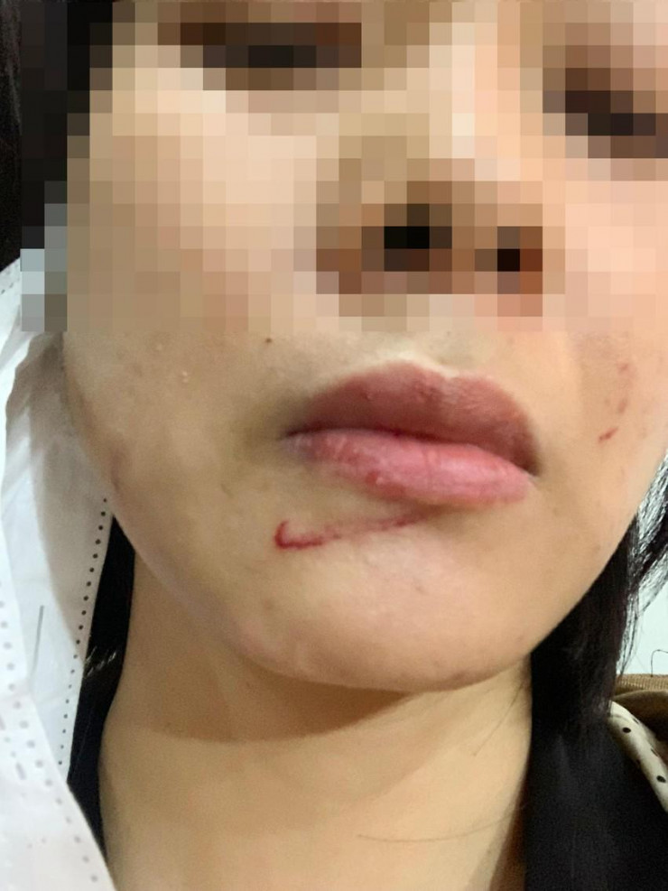Gia Lai: Một phó công an xã bị tố đánh vợ cũ thương tích - 2