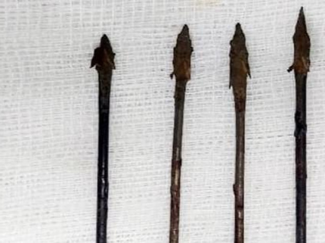 Tin tức trong ngày - Bé trai 11 tuổi trúng 4 mũi tên sắt găm vào vùng mặt