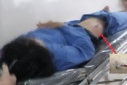 Pháp luật - Khởi tố vụ cán bộ Cục Thuế Ninh Bình bị kẻ bịt mặt dùng dao đâm giữa đường