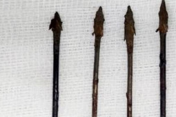 Bé trai 11 tuổi trúng 4 mũi tên sắt găm vào vùng mặt