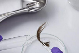 Phi thường - kỳ quặc - Nhận được tin nhắn lạ khuyên đi xét nghiệm ADN, cô gái sốc khi biết thân thế thật sự của mình