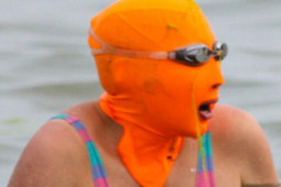 Làm đẹp - Những phương pháp làm đẹp quái dị giờ đã gần như tuyệt chủng