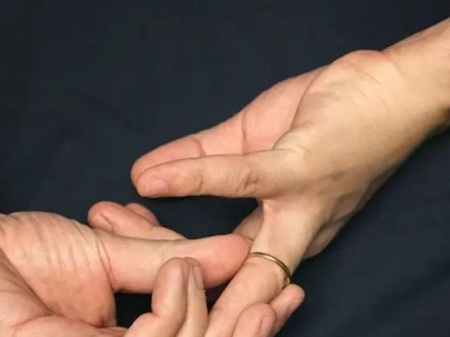 Sức khỏe đời sống - Suýt "hỏng đời trai" vì đeo nhẫn tự chữa rối loạn cương dương cho "cậu nhỏ"