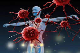 Sức khỏe đời sống - Ung thư máu sẽ không còn là bệnh "tử thần" nếu biết những điều này