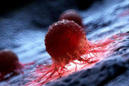 Sức khỏe đời sống - Điều giúp giảm 72% ung thư di căn mà ai cũng có thể làm