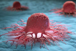 Sức khỏe đời sống - Viêm là "đồng phạm" của ung thư, mắc 4 loại viêm này đừng chần chừ