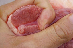 Sức khỏe đời sống - Từ vụ người đàn ông bán thịt nguy kịch vì nhiễm liên cầu khuẩn lợn, chuyên gia chỉ rõ tuyệt đối không làm việc này