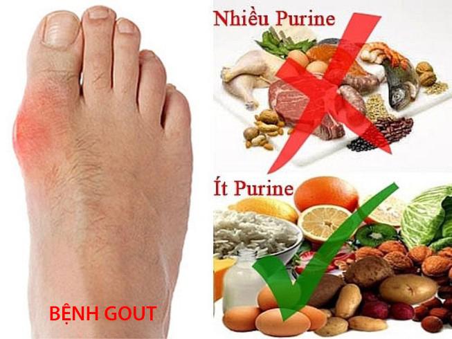 Dinh dưỡng cho người mắc bệnh gout trong dịp Tết - 3