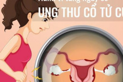 Sức khỏe đời sống - Những hành vi làm tăng nguy cơ ung thư cổ tử cung