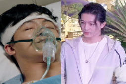 Không thể nhận ra Harry Lu sau tai nạn hỏng hết mặt, phẫu thuật 20 lần
