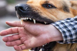 Sức khỏe đời sống - Nam thanh niên lên cơn dại, tử vong sau 4 tháng ăn thịt con chó đã cắn mình