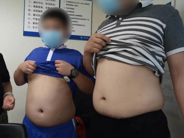 Cậu bé 11 tuổi bị xơ gan nặng, chính thói quen này của bố mẹ là nguyên nhân gây bệnh