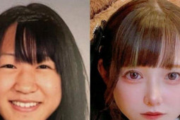 Tiết lộ đụng dao kéo từ năm lớp 5, cô gái Nhật Bản gây tranh cãi