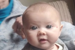 Sức khỏe đời sống - Em bé có đôi mắt xanh đẹp hút hồn - nhưng đó là một triệu chứng nghiêm trọng
