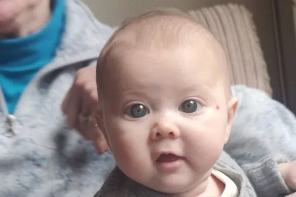 Em bé có đôi mắt xanh đẹp hút hồn - nhưng đó là một triệu chứng nghiêm trọng - 1