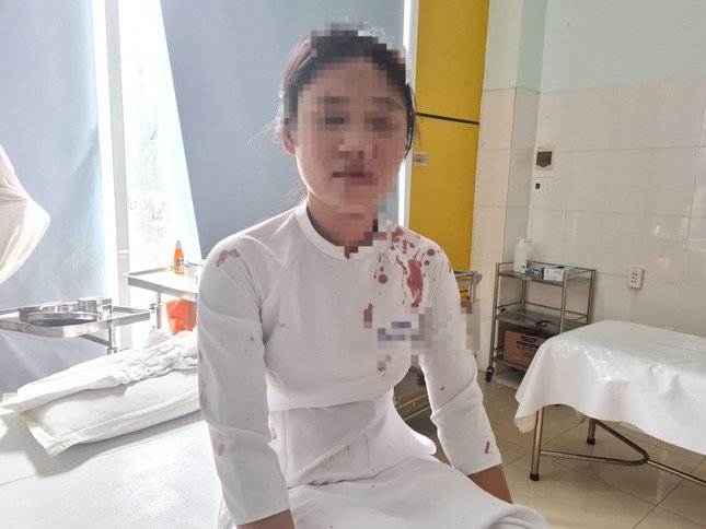 Nữ sinh H.T.M.T. bị bạn dùng guốc đập vào đầu chảy máu