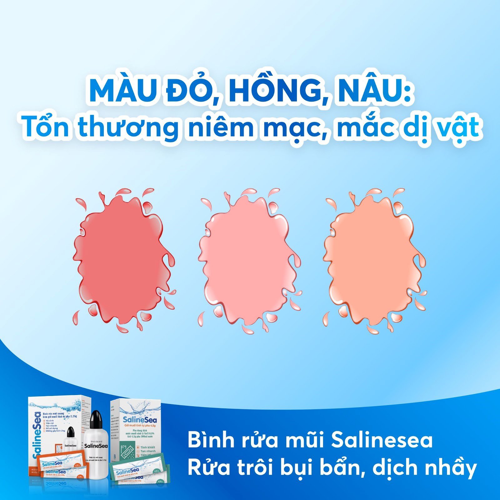 Giải mã bệnh hô hấp qua màu sắc nước mũi - 4