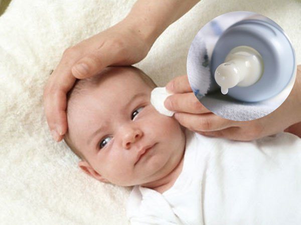 Nguy hiểm khi nhỏ sữa vào mắt trẻ có thể dẫn tới mất hoàn toàn thị lực. Ảnh minh hoạ
