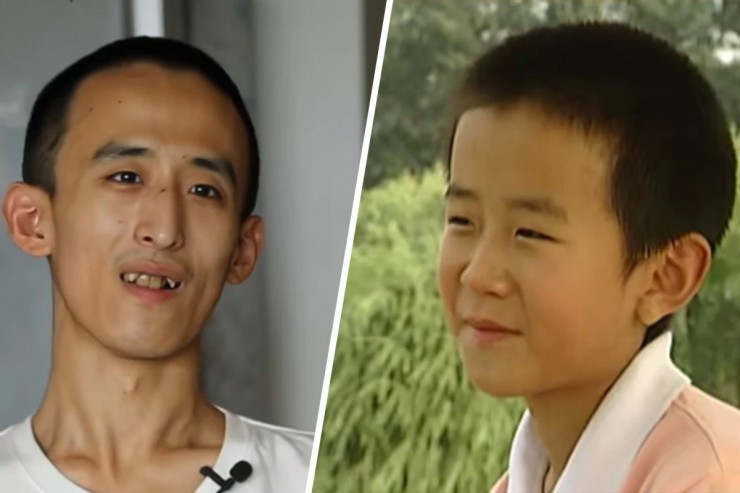 Zhang Xinyang, 28 tuổi, một thần đồng người Trung Quốc từng đỗ vào đại học năm 10 tuổi, giờ đây tin rằng “việc ngồi một chỗ và không làm gì là chìa khóa dẫn đến hạnh phúc suốt đời”.&nbsp;Ảnh: SCMP tổng hợp/Douyin