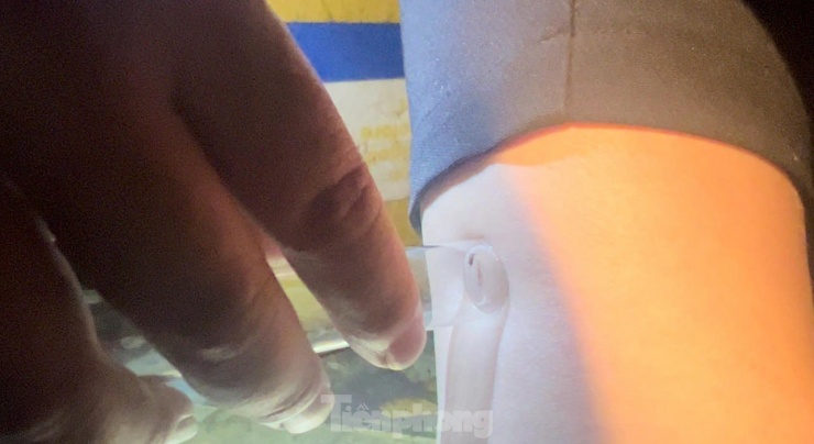 Dùng ống nghiệm bắt muỗi đang say mồi