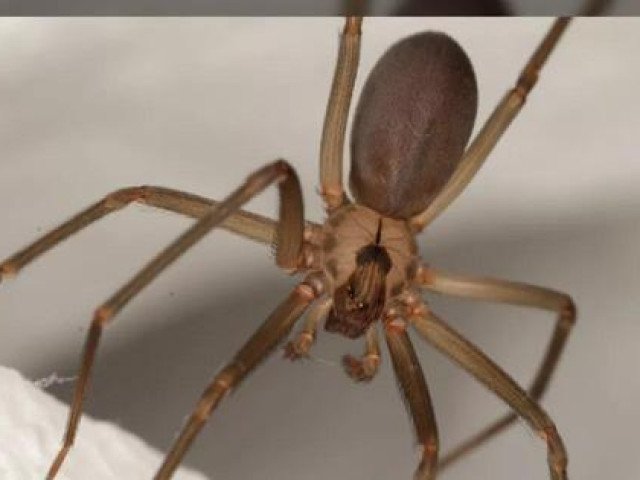 Bệnh lạ: Hai người bị phá hủy hệ miễn dịch sau khi bị nhện cắn