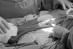 Sức khỏe đời sống - Người đàn ông suýt bị cắt cụt hai chân vì thói quen hàng triệu người vẫn làm