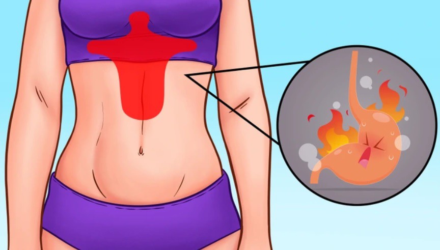 Vị trí đau bụng tiết lộ điều gì về sức khỏe của bạn? - 2
