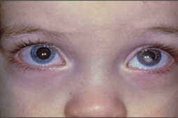 Sức khỏe đời sống - Dấu hiệu của căn bệnh ung thư chết người có thể phát hiện khi chụp ảnh