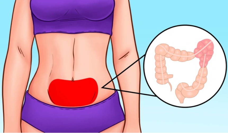 Vị trí đau bụng tiết lộ điều gì về sức khỏe của bạn? - 4