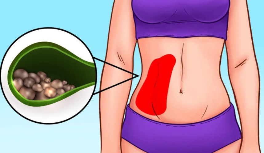 Vị trí đau bụng tiết lộ điều gì về sức khỏe của bạn? - 8