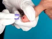 Sức khỏe đời sống - Xét nghiệm nửa giọt máu, phát hiện tất cả các loại ung thư?