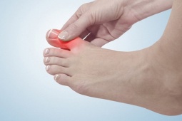 Sức khỏe đời sống - 3 tình trạng này bất ngờ xuất hiện ở ngón chân hãy cẩn trọng, ung thư đang âm thầm tấn công bạn