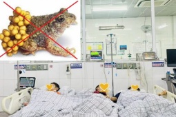 Sức khỏe đời sống - 3 mẹ con suýt chết vì nghe hàng xóm nói ăn thịt cóc giàu dinh dưỡng