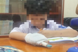 Tin tức trong ngày - Xử lý nghiêm giáo viên tác động vật lý làm học sinh gãy ngón tay