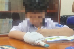 Tin tức trong ngày - Xử lý nghiêm giáo viên tác động vật lý làm học sinh gãy ngón tay