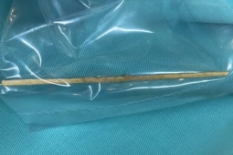 Sức khỏe đời sống - Người đàn ông thủng đại tràng vì thói quen nhiều người mắc phải