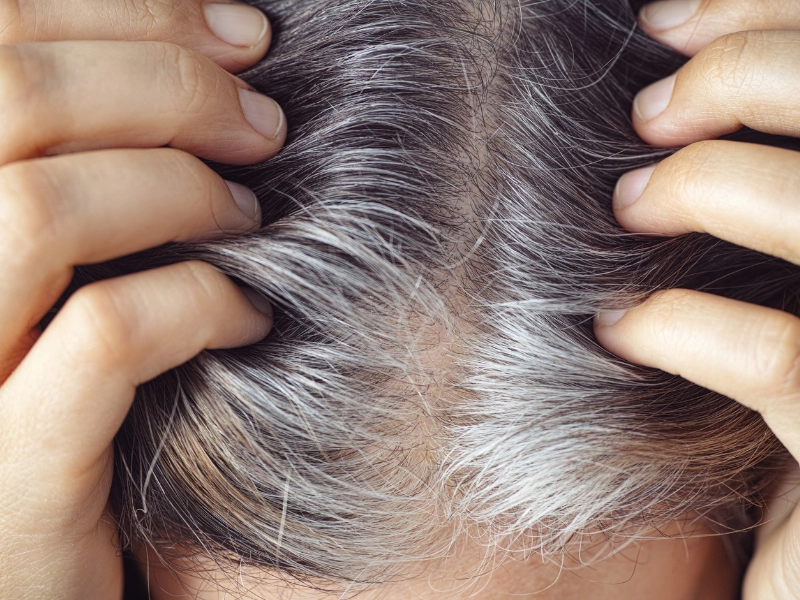Người từ 40 trở lên sẽ gặp cả 2 tình trạng rụng tóc, bạc tóc
