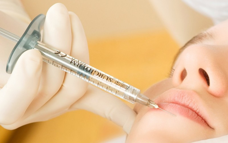 Chất lượng filler cần được kiểm định nguồn gốc rõ ràng