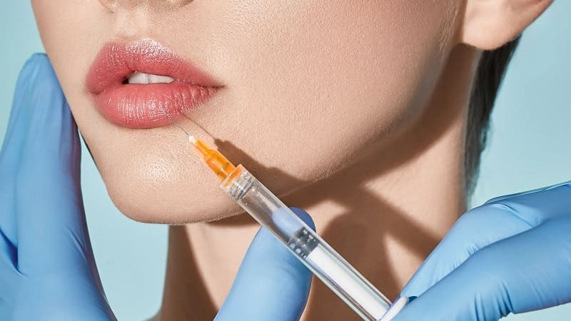 Tay nghề bác sĩ là tiêu chí quyết định đến địa chỉ tiêm filler uy tín