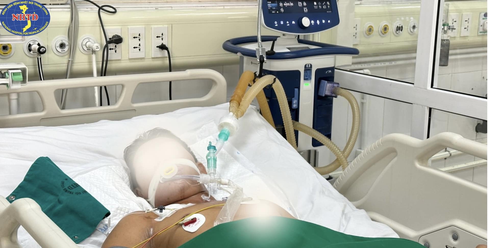 Người đàn ông cắt trĩ tại nhà.