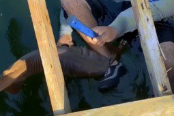 Mỹ: Bị cá mập ngoạm chặt chân, dùng búa gỡ cũng không ra