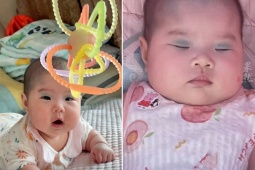Bạn trẻ - Cuộc sống - Em bé có vết bớt hiếm gặp, giống như bé biết trang điểm từ trong bụng mẹ