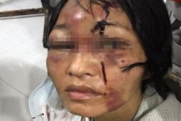 Pháp luật - Gã "chồng hờ" đánh đập vợ con tàn bạo